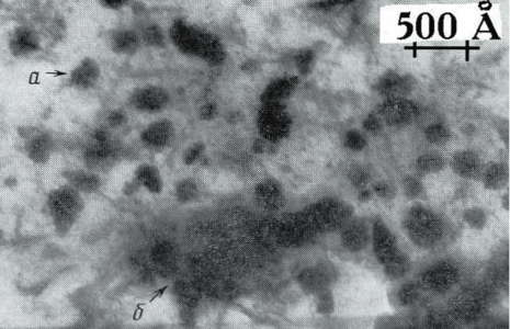 Рис. 3 Фото надмолекулярной структуры частиц угольного вещества при увеличении в 198000 раз (по данным А.Т. Айруни, ИПКОН)